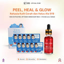 SYB Bundling 2in1 - NEW SYB Red Jelly Serum with Niacinamide 10% + Peel Off Mask kemasan sachet 1 Box
