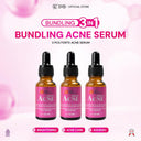 NEW SYB FORTE ACNE SERUM