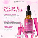 NEW SYB FORTE ACNE SERUM