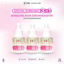 NEW SYB FORTE ACNE SERUM