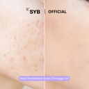 NEW SYB PEELING SERUM VITAMIN C + COLLAGEN