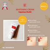 SYB WHITENING CREAM LIPATAN KULIT - SYBofficial